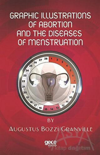 Graphic Illustrations Of Abortion And The Diseases Of Menstruation